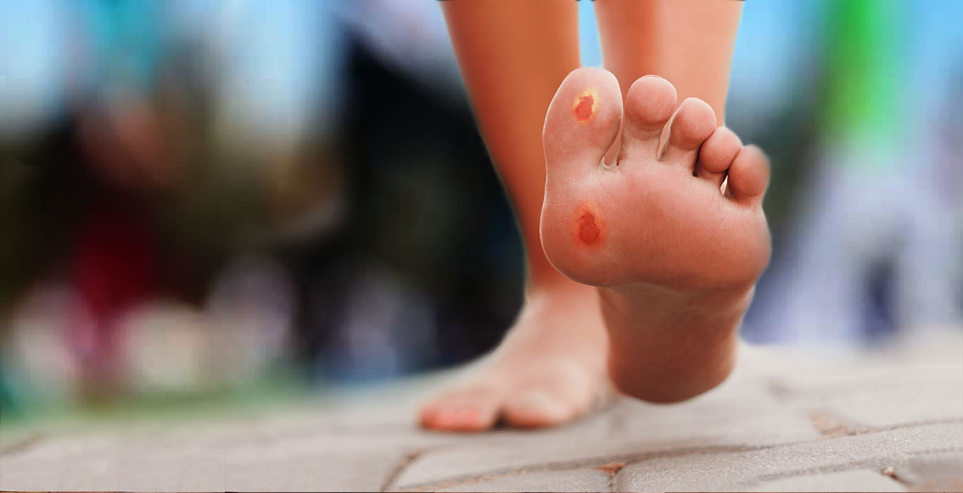 Diabetic Neuropathy - Footpro Solutions