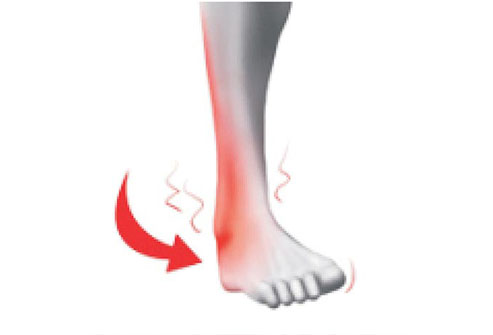 Ankle Pain