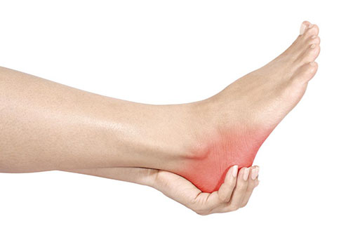 Heel Pain