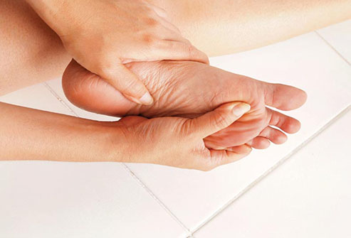 Plantar Fasciitis