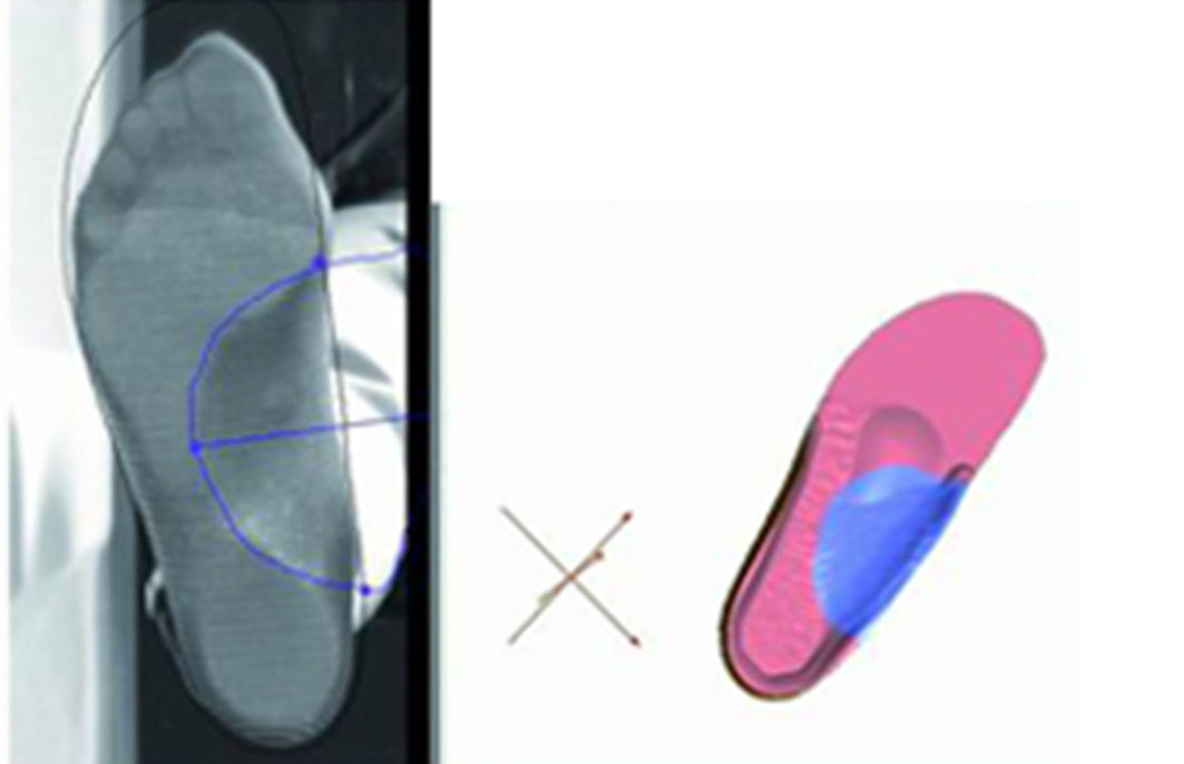 3D CAD Modeling of insoles